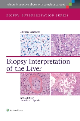 Biopsy Interpretation of the Liver by Michael Torbenson