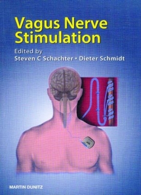 Vagus Nerve Stimulation book