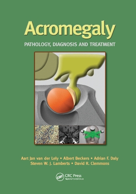 Acromegaly: Pathology, Diagnosis and Treatment book