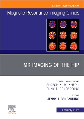 MR Imaging of the Hip, An Issue of Magnetic Resonance Imaging Clinics of North America: Volume 33-1 book