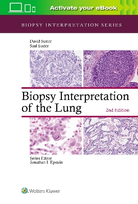 Biopsy Interpretation of the Lung book