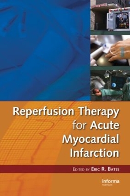 Reperfusion Therapy for Acute Myocardial Infarction book