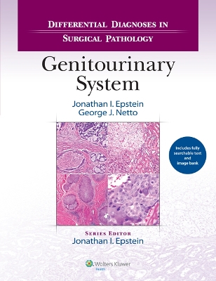 Differential Diagnoses in Surgical Pathology: Genitourinary System book