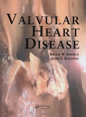 Valvular Heart Disease by Bruce Andrus