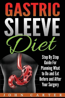 Gastric Sleeve Diet: Step By Step Guide For Planning What to Do and Eat Before and After Your Surgery by John Carter