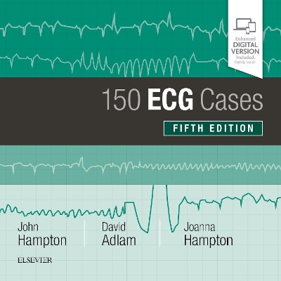 150 ECG Cases book