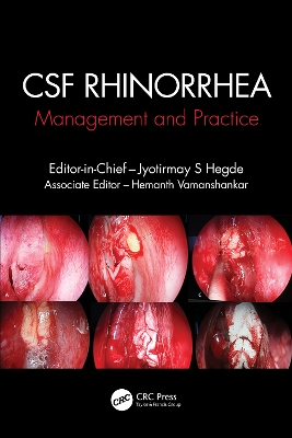 CSF Rhinorrhoea: Management and Practice by Jyotirmay S. Hegde