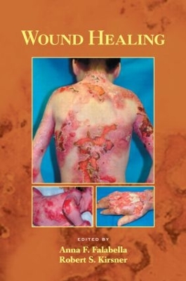 Wound Healing book