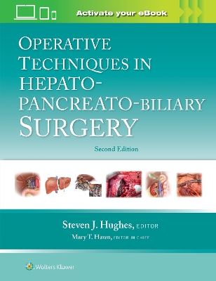 Operative Techniques in Hepato-Pancreato-Biliary Surgery: Print + eBook with Multimedia by Steven J. Hughes