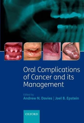 Oral Complications of Cancer and its Management book
