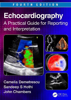 Echocardiography: A Practical Guide for Reporting and Interpretation by John Chambers