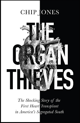 The Organ Thieves: The Shocking Story of the First Heart Transplant in America's Segregated South by Chip Jones