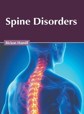 Spine Disorders book