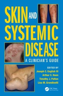 Skin and Systemic Disease by Joseph C. English III