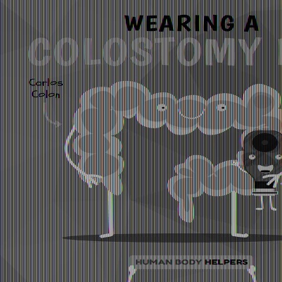 Wearing a Colostomy Bag by Harriet Brundle