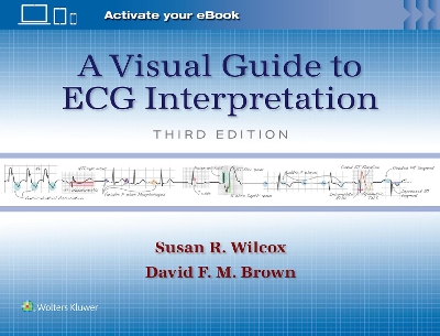 A Visual Guide to ECG Interpretation: Print + eBook with Multimedia book