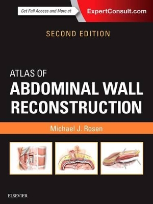 Atlas of Abdominal Wall Reconstruction book