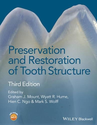 Preservation and Restoration of Tooth Structure 3E book