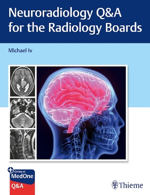 Neuroradiology Q&A for the Radiology Boards book