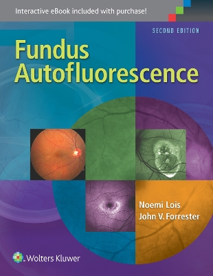 Fundus Autofluorescence book