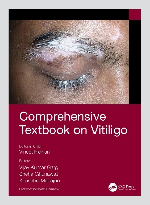 Comprehensive Textbook on Vitiligo book