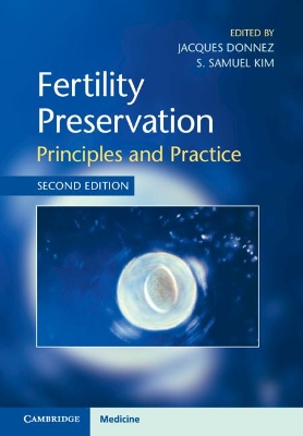 Fertility Preservation: Principles and Practice book