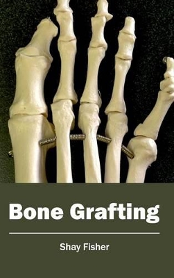 Bone Grafting book