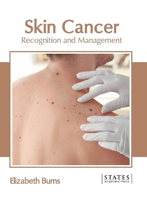 Skin Cancer: Recognition and Management book