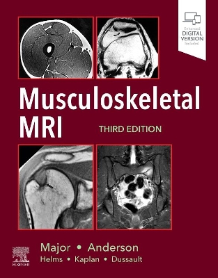 Musculoskeletal MRI book