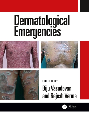 Dermatological Emergencies book