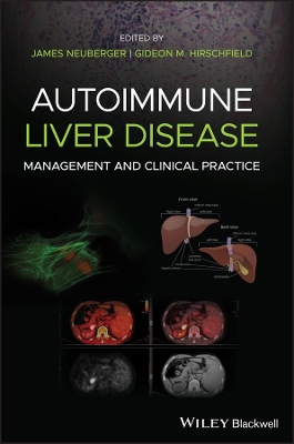 Autoimmune Liver Disease: Management and Clinical Practice by James Neuberger