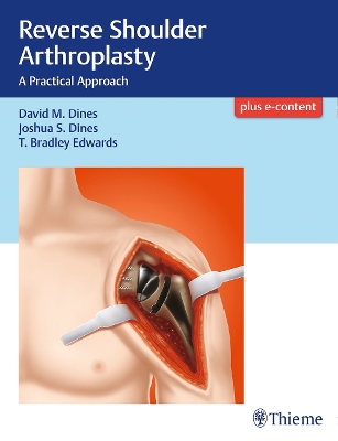 Reverse Shoulder Arthroplasty book