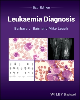 Leukaemia Diagnosis book