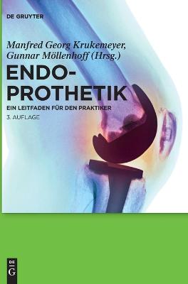 Endoprothetik book