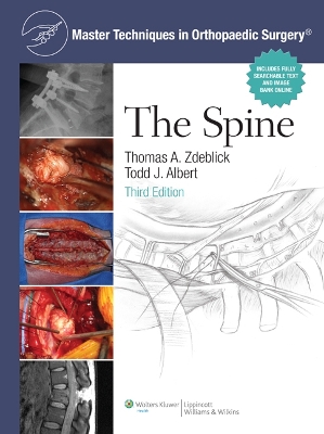 Master Techniques in Orthopaedic Surgery: The Spine book