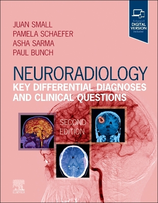 Neuroradiology: Key Differential Diagnoses and Clinical Questions book