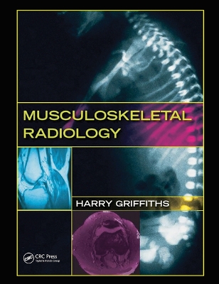 Musculoskeletal Radiology by Harry Griffiths