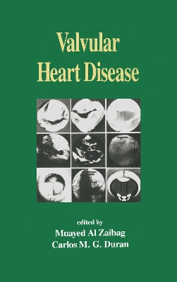 Valvular Heart Disease book