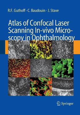 Atlas of Confocal Laser Scanning In-vivo Microscopy in Ophthalmology book