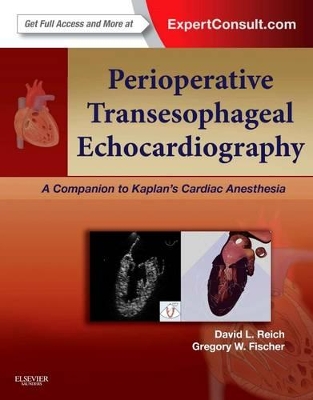 Perioperative Transesophageal Echocardiography book