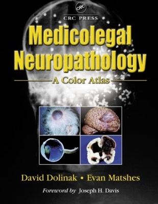 Medicolegal Neuropathology book