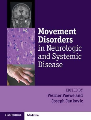 Movement Disorders in Neurologic and Systemic Disease book