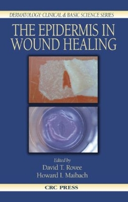 Epidermis in Wound Healing by David T. Rovee
