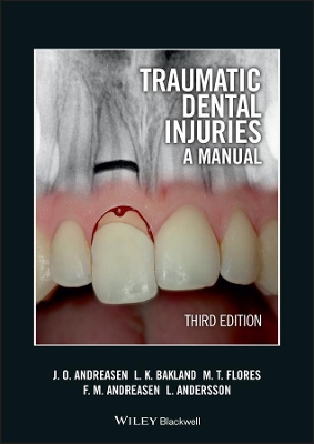 Traumatic Dental Injuries - a Manual 3E book