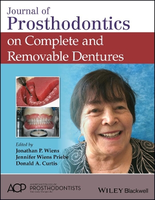 Journal of Prosthodontics on Complete and Removable Dentures book