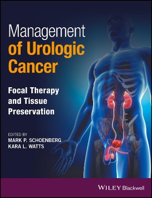 Management of Urologic Cancer book