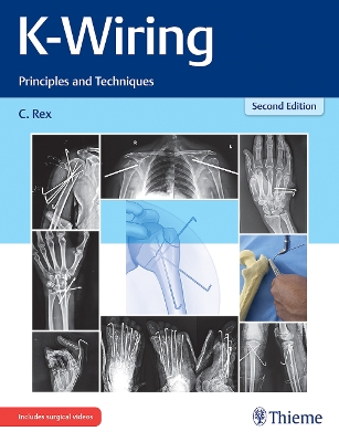 K-Wiring: Principles and Techniques book