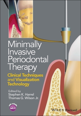 Minimally Invasive Periodontal Therapy book