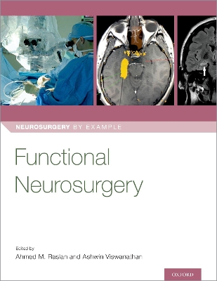 Functional Neurosurgery book