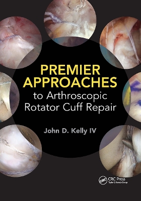 Premier Approaches to Arthroscopic Rotator Cuff Repair book